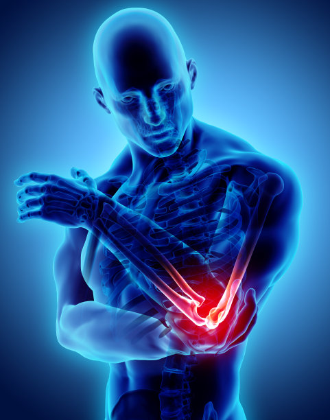 人体肘部损伤的三维示意图。图片下载