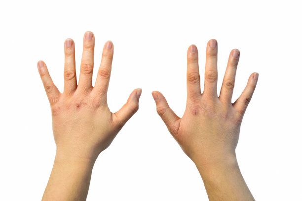 检查手图片下载