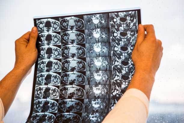 医生在白大褂检查结果磁共振成像(MRI)的女性髋关节图片下载