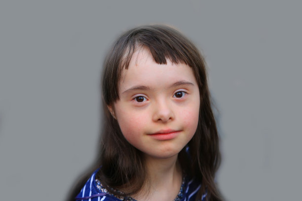 灰色背景下可爱的唐氏综合症女孩图片下载