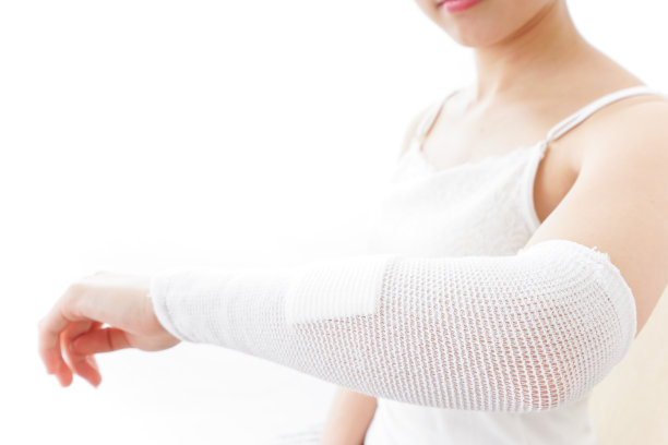 一个女人的手臂受伤了图片下载