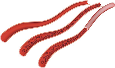 血管图片下载