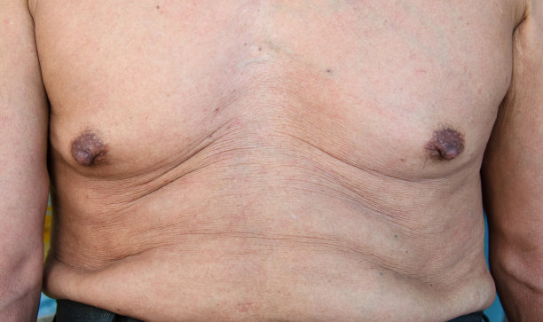 一个腹部有脂肪团的老人图片下载