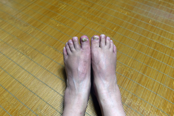 运动员的脚和爪子图片下载