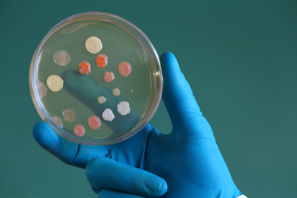 微生物学家拿着一个覆盖着菌落的琼脂培养皿图片下载