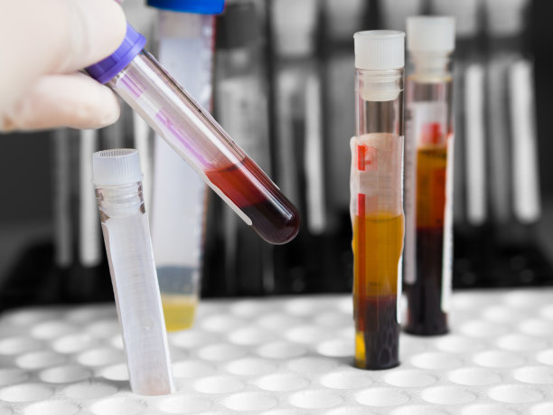 在医院诊疗前，技术人员或医生手戴医用手套，手持输血管进行实验室检测图片下载