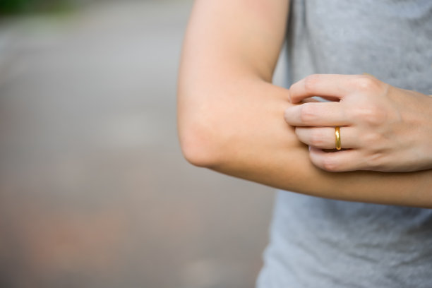 健康问题。特写亚洲女孩抓她发痒的手臂素材图片