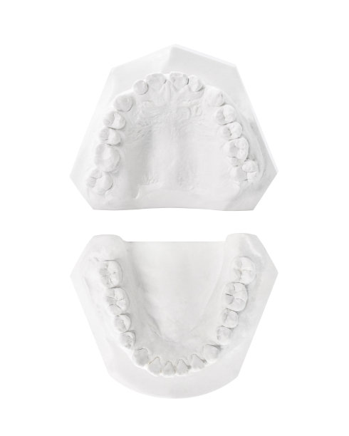 牙科石膏模型的牙齿孤立在白色背景。石膏做的牙齿模板。剪辑路径对象。图片下载