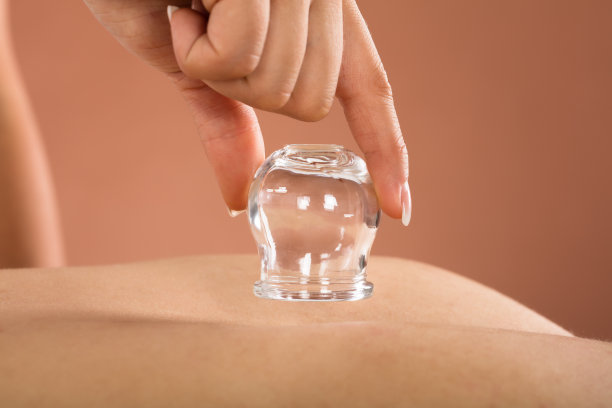 理疗师给手拔火罐素材图片