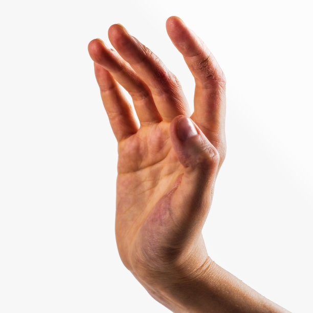 女性的手，皮肤非常干燥图片下载