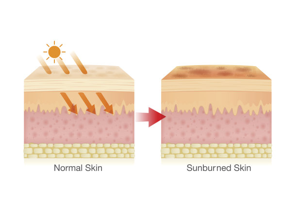 阳光对皮肤的影响。图片下载