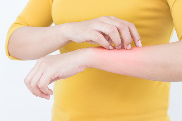 妇女抓痒在手臂表面，保健概念。图片下载