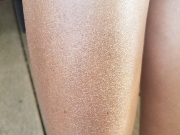 一个女人干瘪发痒的腿素材图片