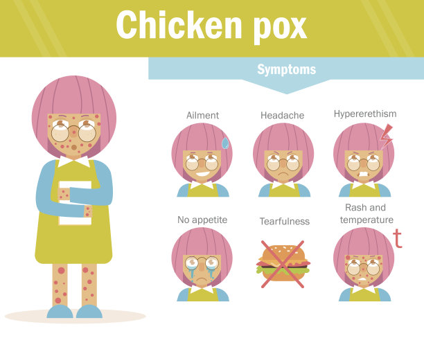 水痘。向量。卡通图片下载