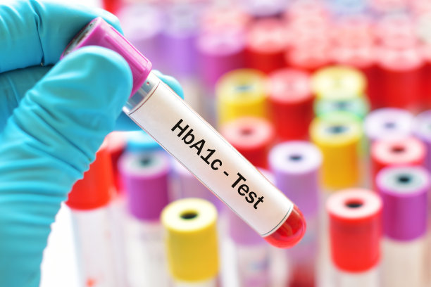 糖化血红蛋白(HbA1c)测试素材图片