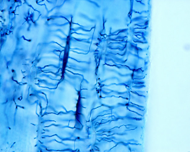 骨细胞：Schmorl技术图片下载