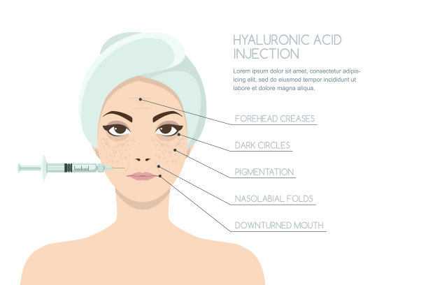 透明质酸面部注射，矢量信息图设计模板。美容、美容、抗衰老的概念。图片下载