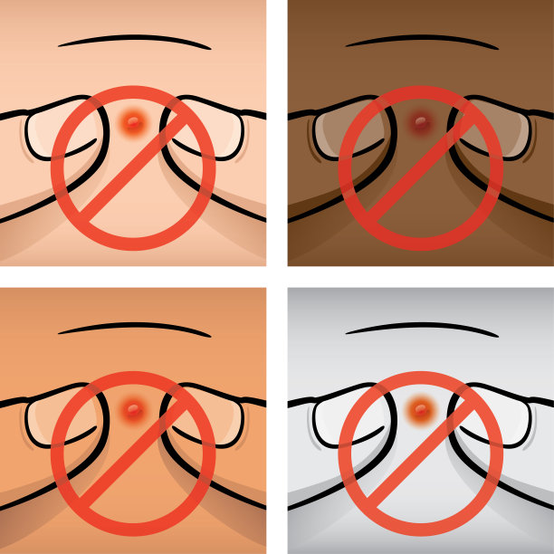 插图禁止任何人用手指挤痘痘，种族。理想的医疗，信息和机构目录图片下载