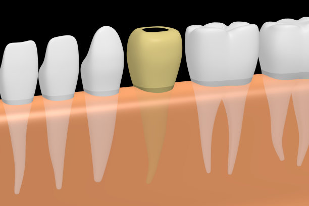 3 d蛀牙图片下载