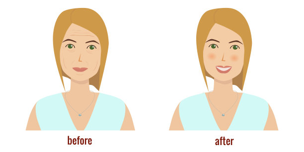 一个女人在面部护理前后的脸。嫩肤的概念。胶原蛋白。整容手术图片下载