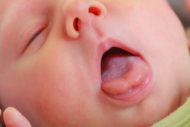 新生儿脸的特写，嘴张着图片下载