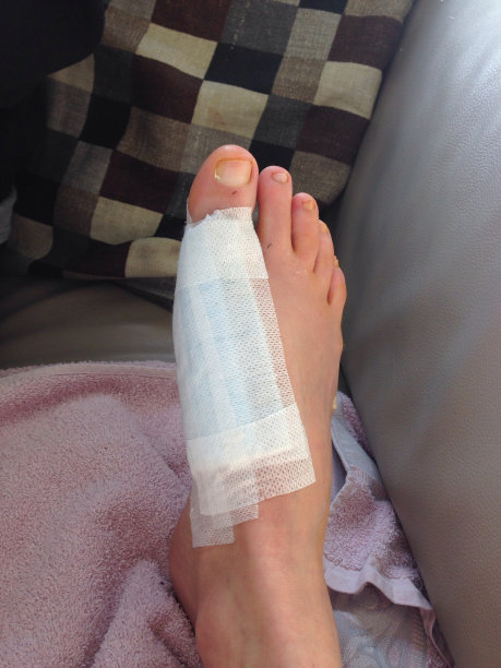 缝合足部伤口图片下载