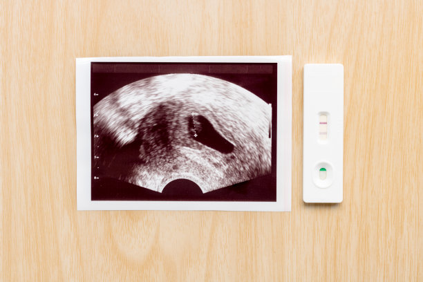 妊娠测试与超声波照片婴儿在木制背景。孕期保健的概念。图片下载