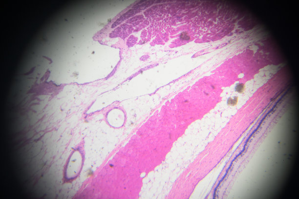 光镜下眼碗活检图片下载