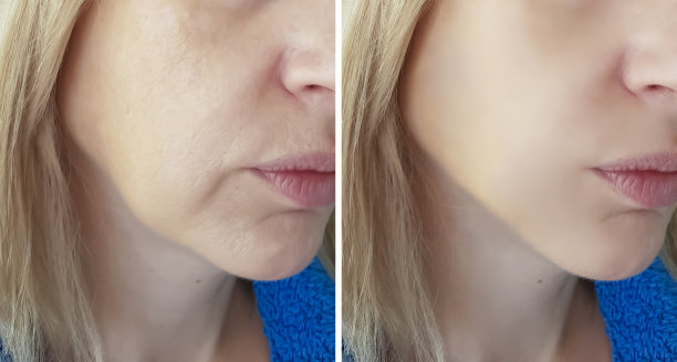 女人脸上皱纹前后图片下载