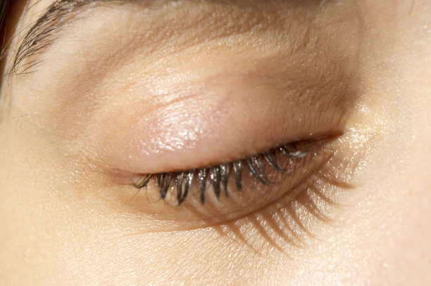 眼睛大麦感染图片下载