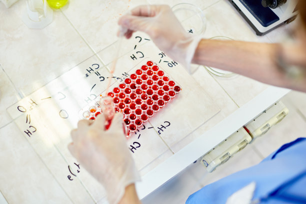 化验师分析血液样本图片下载