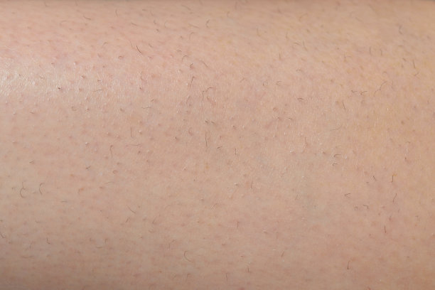 腿上长了毛的一块皮肤。图片下载