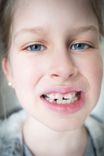 恒牙损伤图片下载