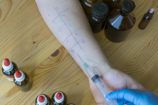 过敏测试素材图片