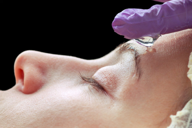 针消脂。美容师在一位妇女的脸上做针刺治疗素材图片