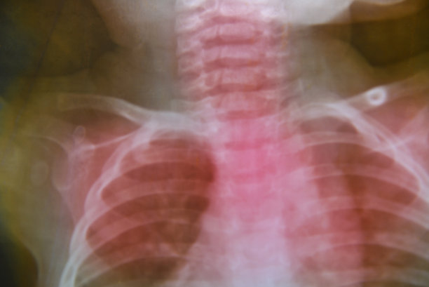 X射线胶片上有红色滤光片医学背景。图片下载