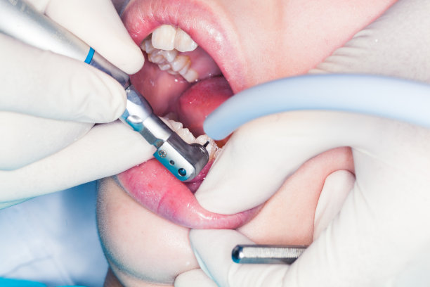 矫正照片素材ID：314380734