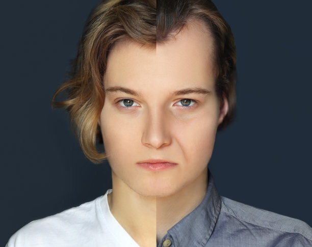 痤疮:之前和之后图片下载