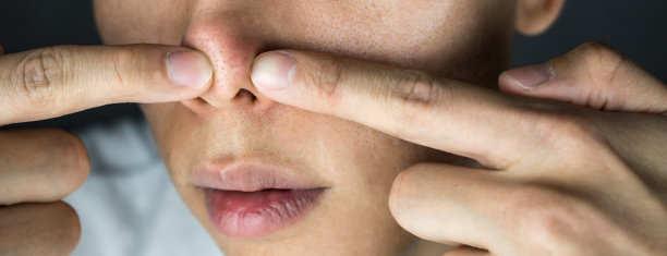 近距离挤压鼻子上的痤疮图片下载