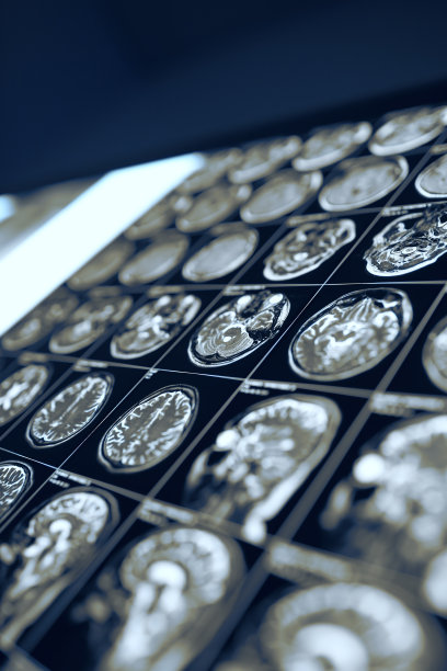 人脑扫描在医生办公室的视图框上图片下载