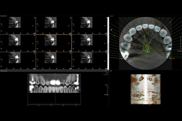 牙科牙齿3D x光图片下载