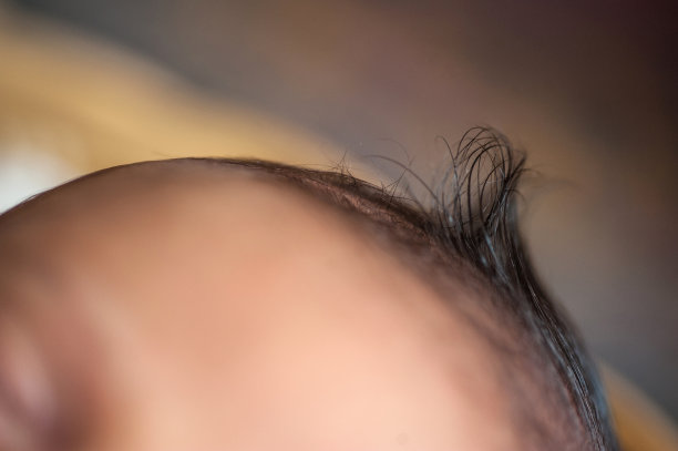 婴儿头顶图片下载