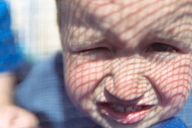 有雀斑的男孩图片下载