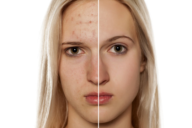 对比肖像的女性脸部，前后美容治疗图片下载
