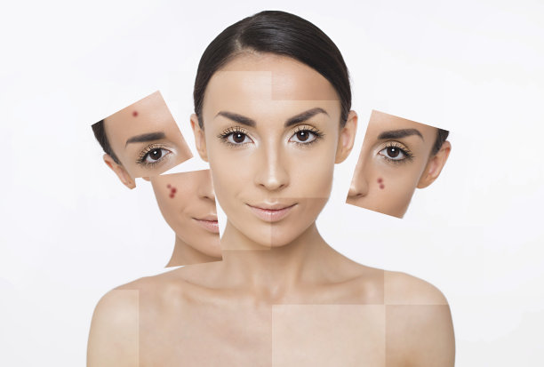 面部皮肤问题。脸的一部分素材图片