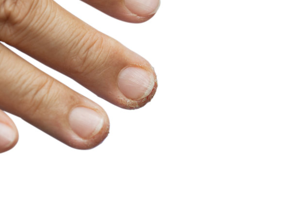 皮肤过敏。图片下载