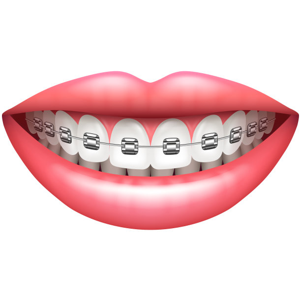 牙齿带着牙套的女人微笑孤立在白色向量上图片下载