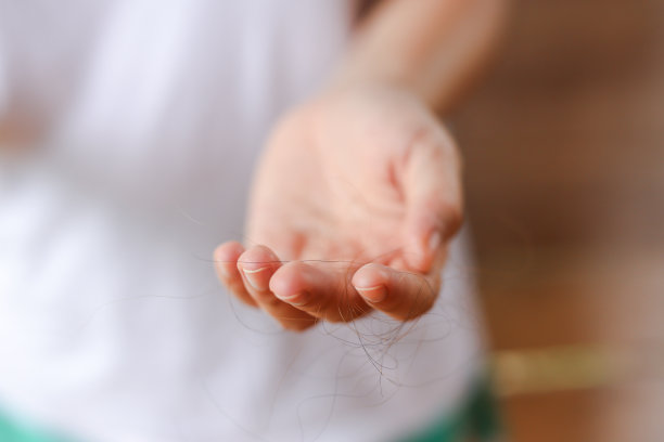 头发在梳子上掉下来，头发每天掉下来都是严重问题。图片下载