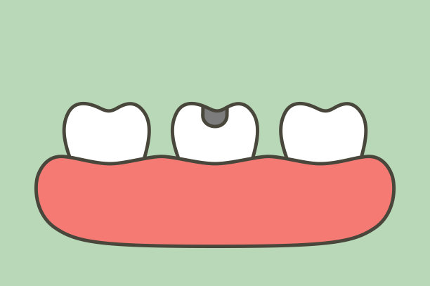 蛀牙或龋齿图片下载