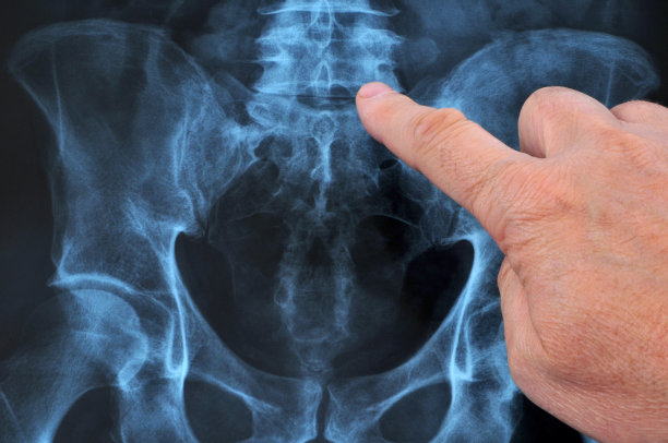 男性骨盆x光检查图片下载